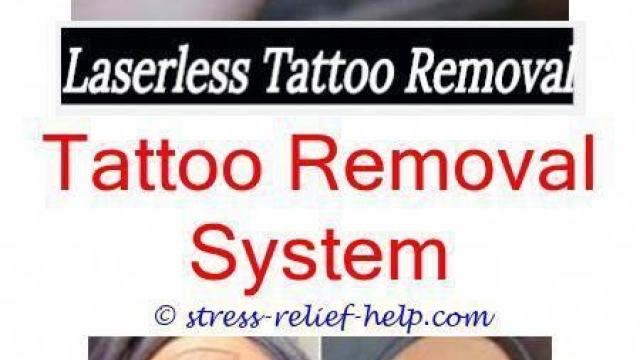 Low Cost Tattoo Removal – Your Solution With Regard To An Unwanted Tattoo