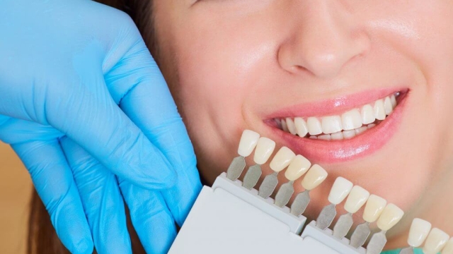 Shining Smiles: Discover the Best Teeth Whitening Products